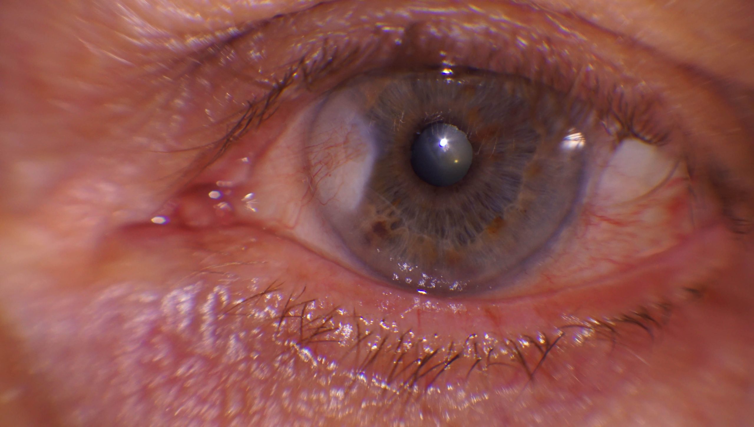 Rocío Villena, vencedora del 1er Concurso de Fotografía para Ópticos-Optometristas de CIONE