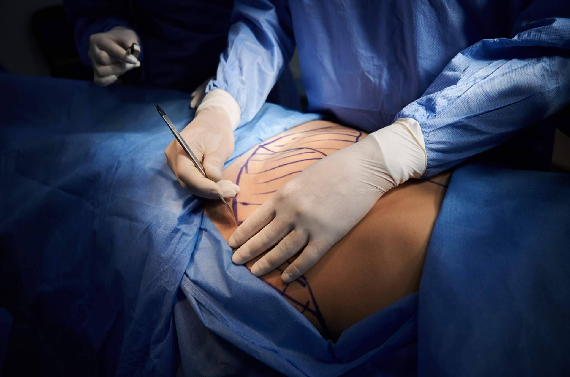 A2Clinic contribuye a mejorar la calidad de vida con la cirugía de reducción de pecho