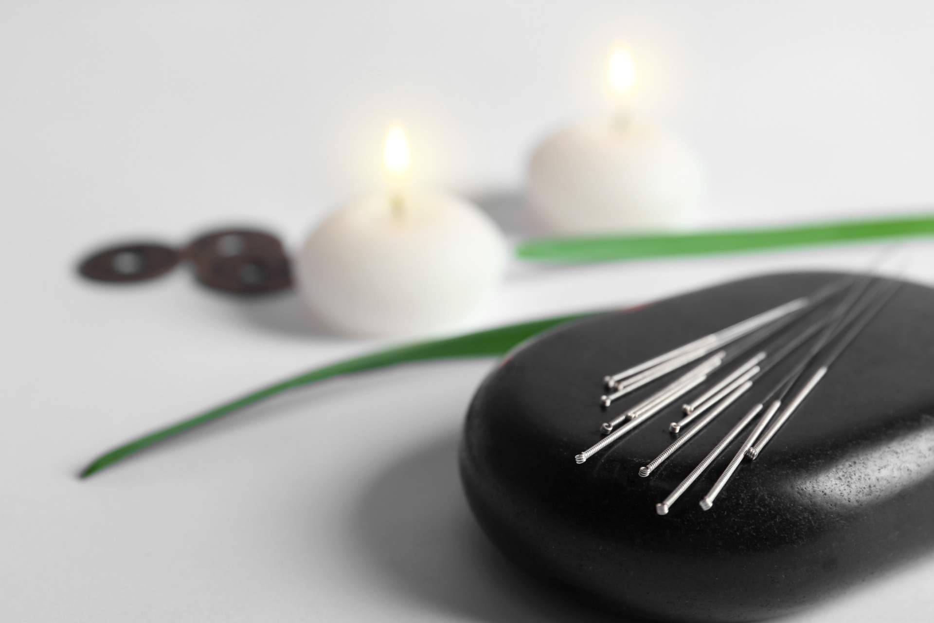 Las terapias de acupuntura de Shenti Wellness