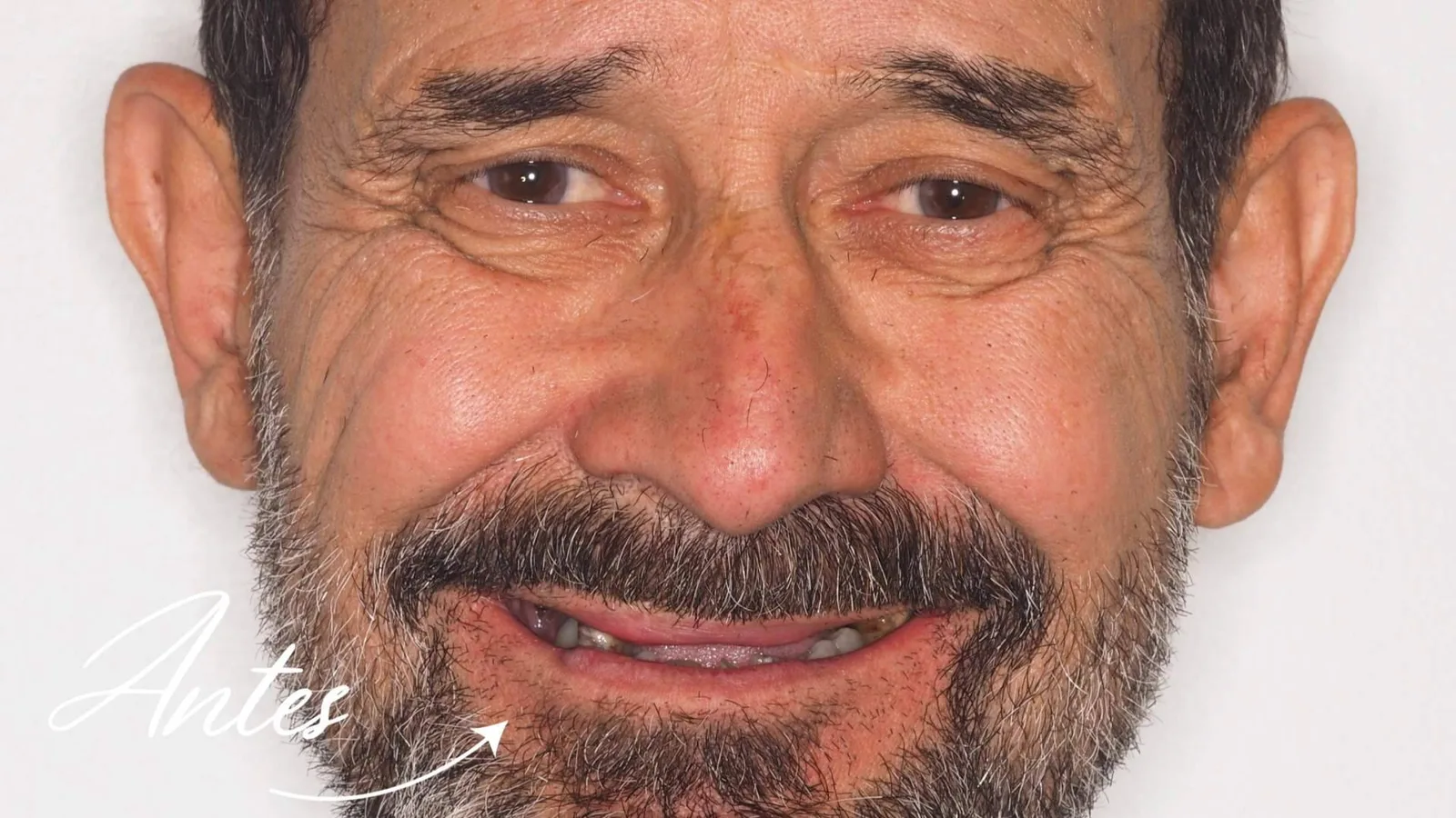 Clínica Calvo de Mora se consolida como referente en cirugía maxilofacial e implantología dental avanzada en Madrid