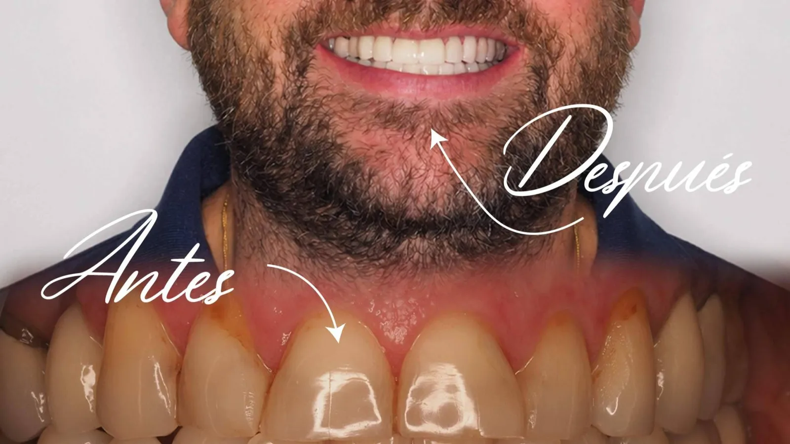 Implantes dentales y cirugía maxilofacial avanzan con tecnología digital en Clínica Calvo de Mora